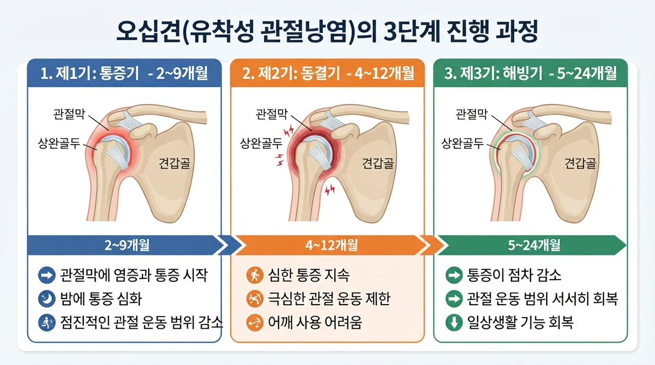 오십견 진행 단계 확인