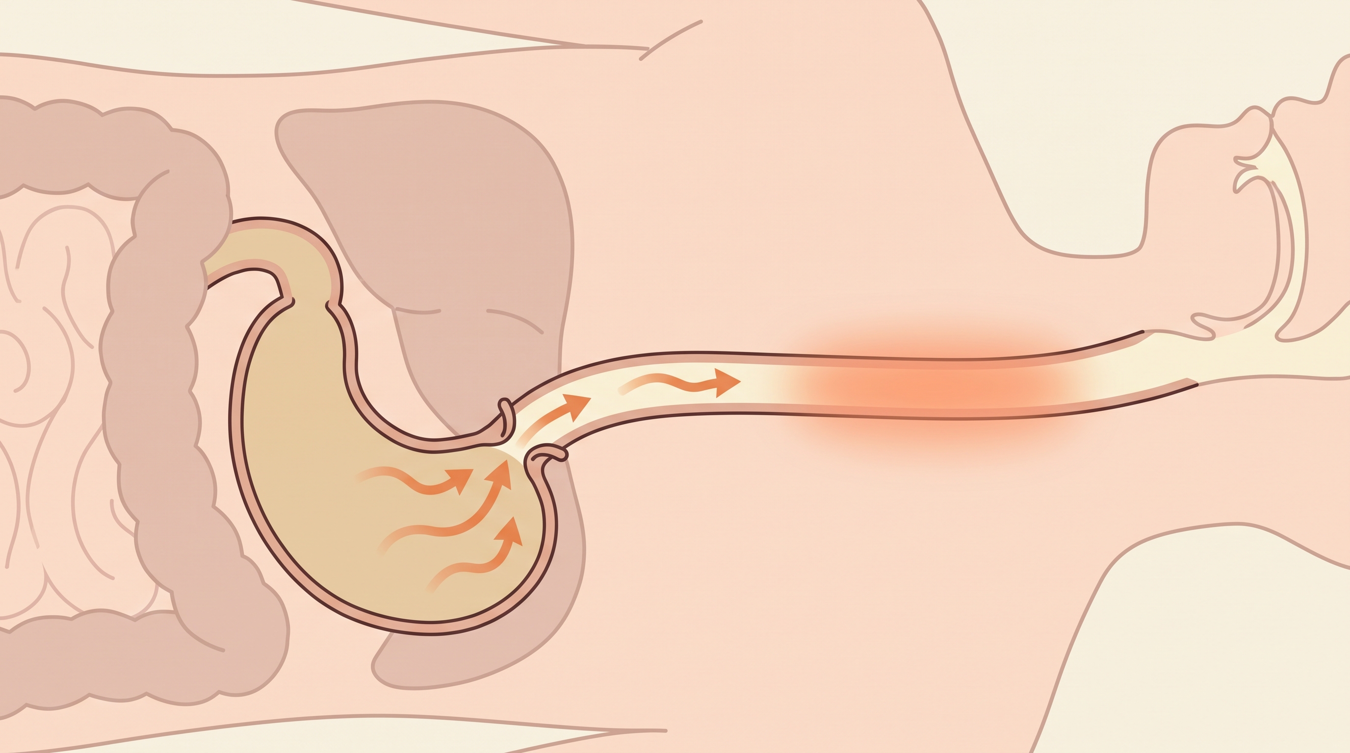 눕는 순간 위산이 거꾸로 흐르는, 아주 단순한 물리 이야기
